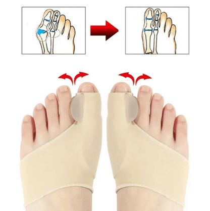 ComfortToe Corrector (1 Par) de Juanetes Ortopedicos